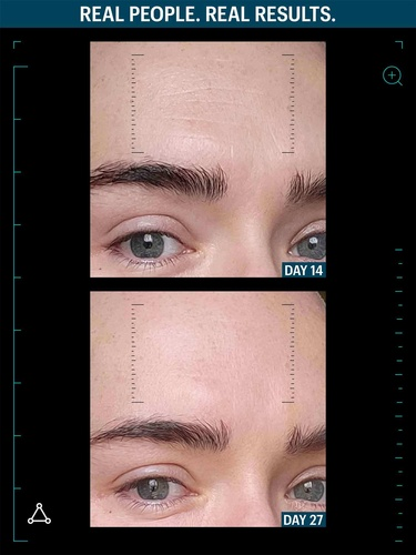 Allies Of Skin Multi Peptides y Gf Advanced Lifting Serum 30 мл