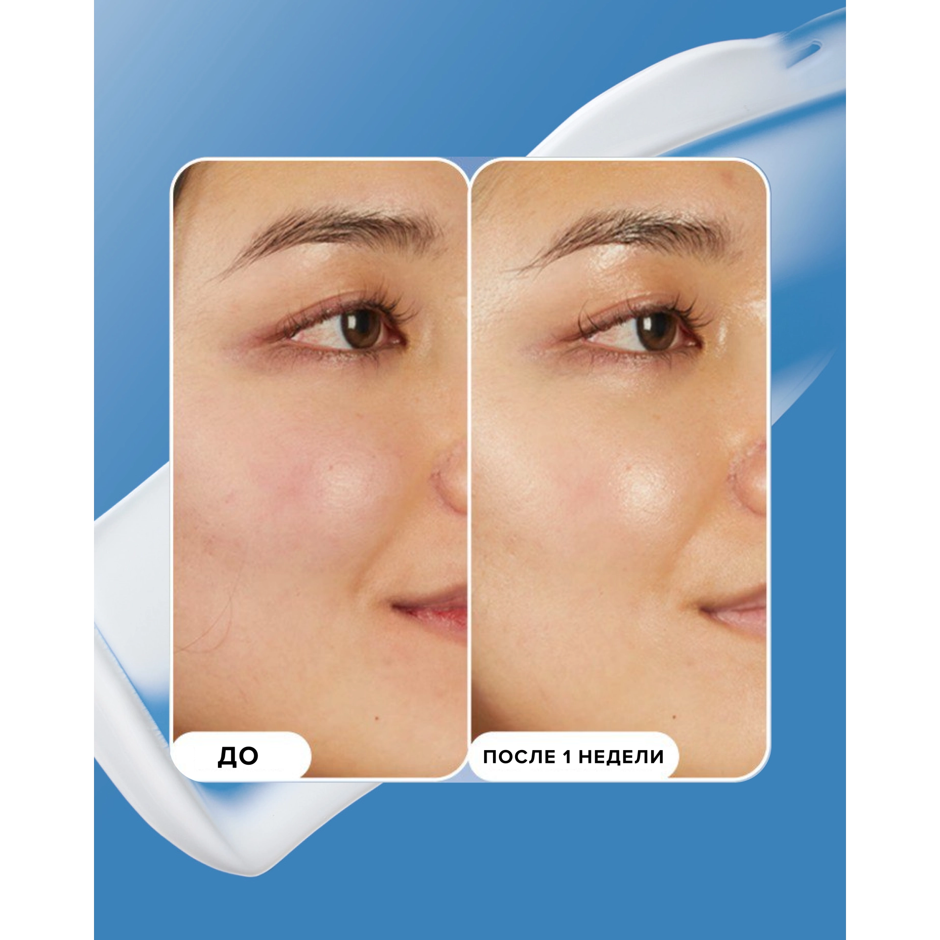 7% ECTOIN BARRIER BOOSTER / БУСТЕР С 7% ЭКТОИНОМ ДЛЯ ЗДОРОВОГО БАРЬЕРА